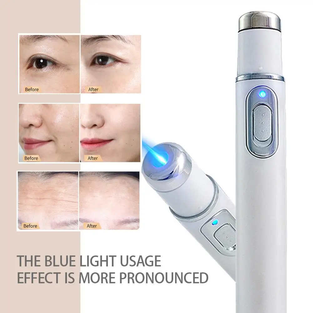Blue Light Pen Eye Massager Eye Massage Instrument Dark Circles Eye Bag Puffiness Under Eye And 4 Styles Moisturizing Eye Cream
