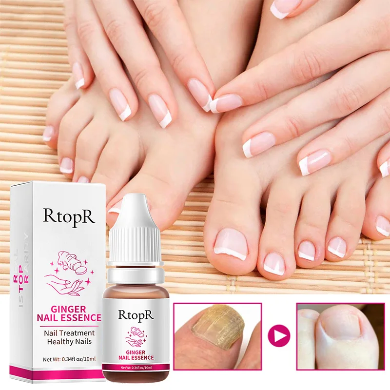 

1pc Ginger Nail Care Lotion Repair Damaged Rough Nails Thicken Crack Nail Gentle Protection Of Nails Care Lotion