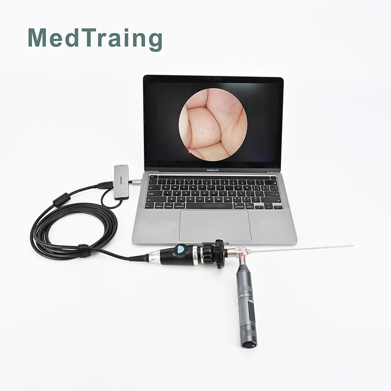 HD 1080P Medical USB Camera Endoscopy Camera for Surgery Gynecology Proctology and ENT Examination and Treatment