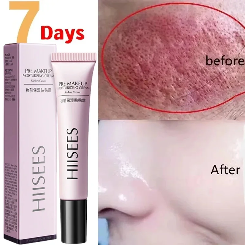 

Instant Facial Redness Repair Cream Soothing Red Blood Rosacea Treatment Improve Sensitive Skin Anti Redness Skin Care Cosmetics