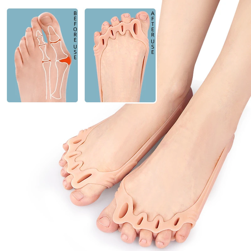 

2Pairs Gel Silicone Forefoot Pad Five Toe Separator Elastic Tension Band Overlap Hallux Valgus Corrector Decompression Massage