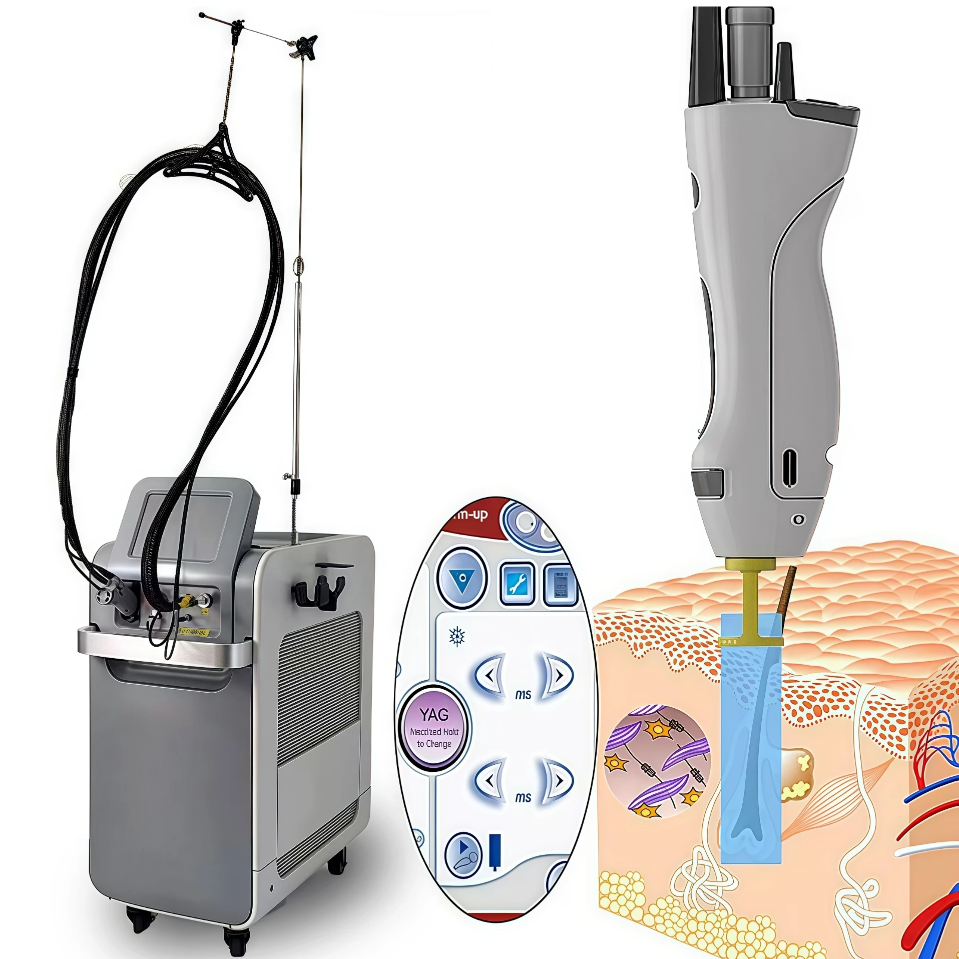 

High quality 1064nm painless hair removal Clinic 755NM alexandrite machine