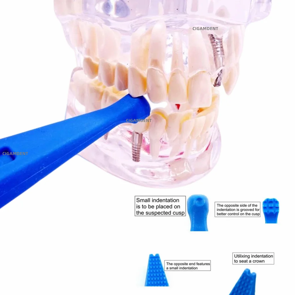 1Pc Dental Instruments Cracked Teeth Explorer Probe Tooth Cavities Locator Fracture Detector Crown Bridge Seater Blue
