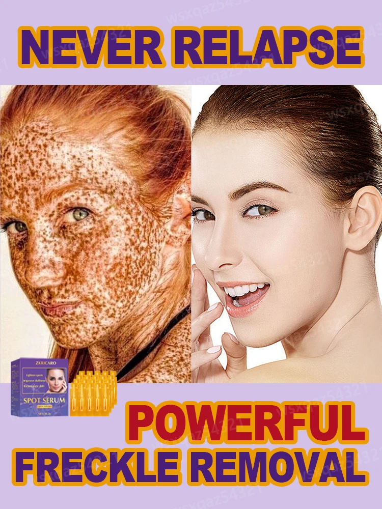 Solve various facial problems, brighten skin tone, and give you flawless white skin