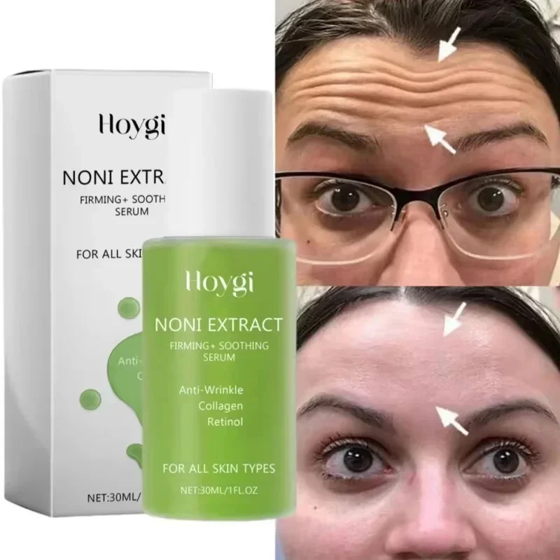 

Noni Fruit Anti-wrinkle Face Serum Instant Anti-Aging Lift Firming Fade Fine Line Moisturizing Brighten Skin Care For Men Women