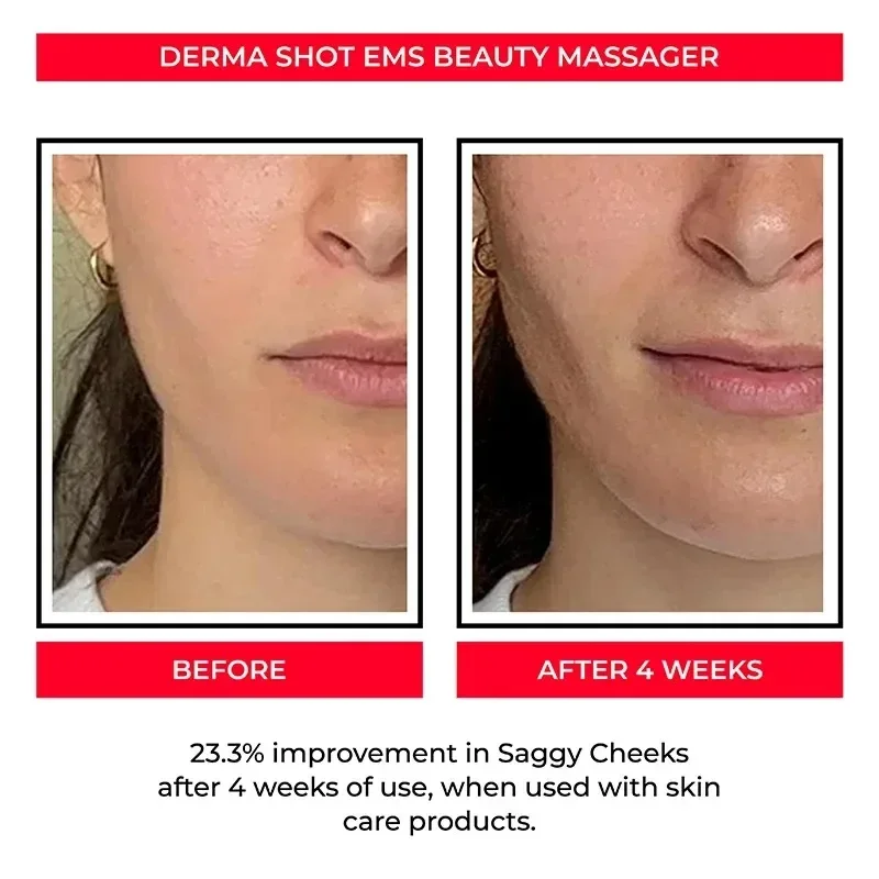 أداة تجميل الوجه الكهربائية بالتيار الصغير، أداة تدليك شد الوجه، أجهزة تجميل لتدليك الذقن المزدوجة الرقيقة #5