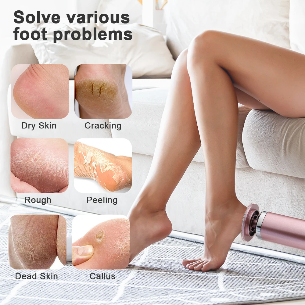 Lima elettrica per piedi Macchina per pedicure Strumento per pedicure ricaricabile per la rimozione della pelle morta e della cuticola con sabbia sostitutiva