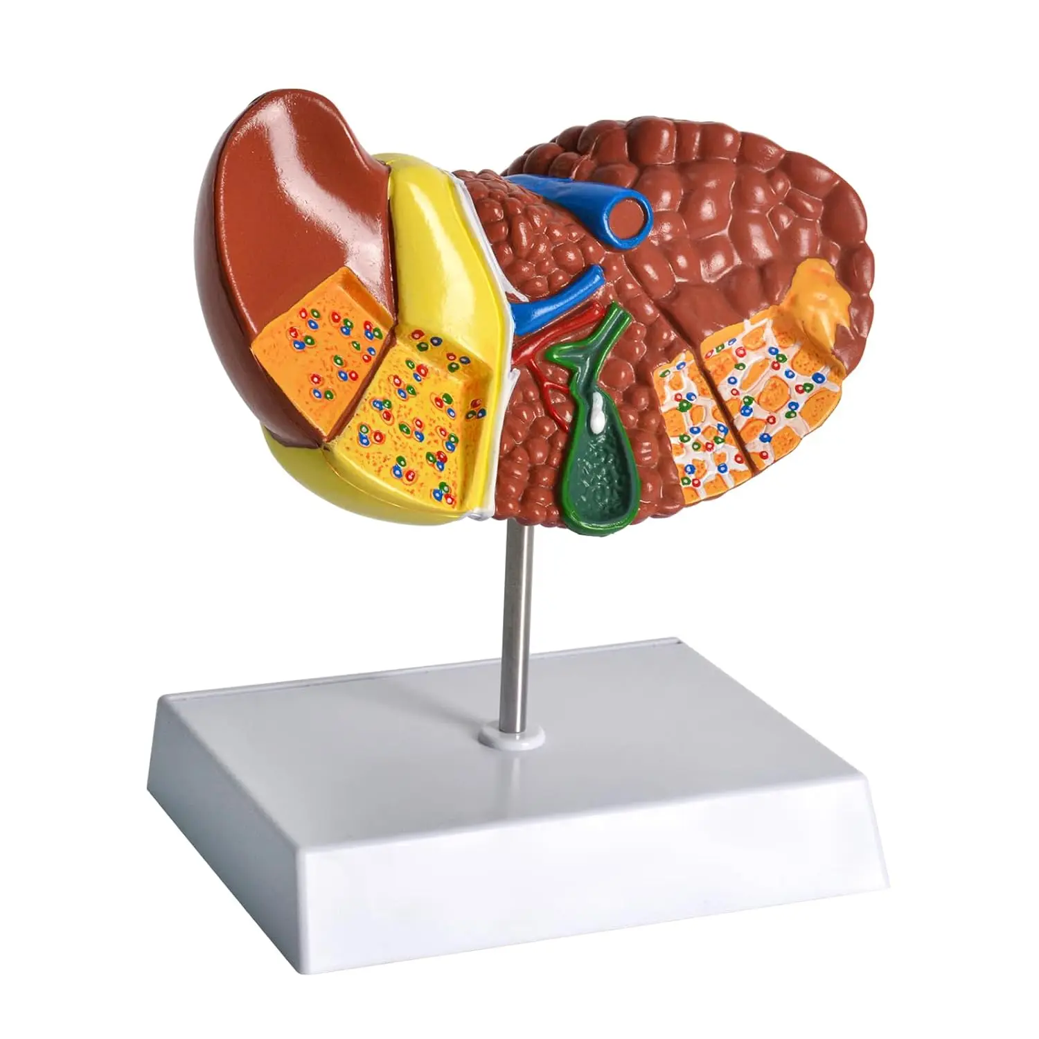 Features Liver Cirrhosis Model Human Anatomical Pathology Liver Clear Texture PVC for School Student Study Research Education