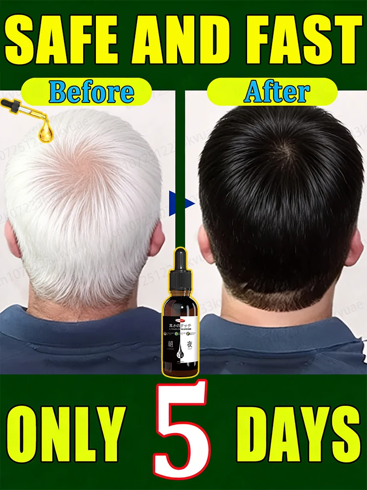 

Серые волосы можно быстро снимать в 7-дне годы, восстанавливает волосы к оригинальному цвету. Подходит для людей всех возрастов.