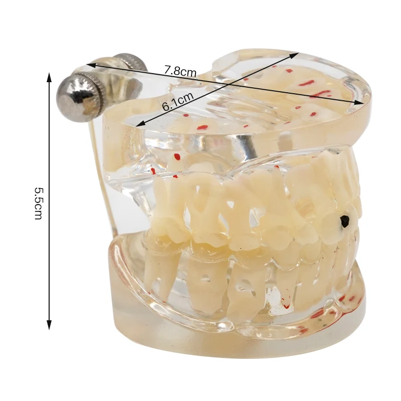 Modello dentale per bambini Denti primari e permanenti per bambini Modello alternativo con denti di carie per studio di formazione pratica del dentista