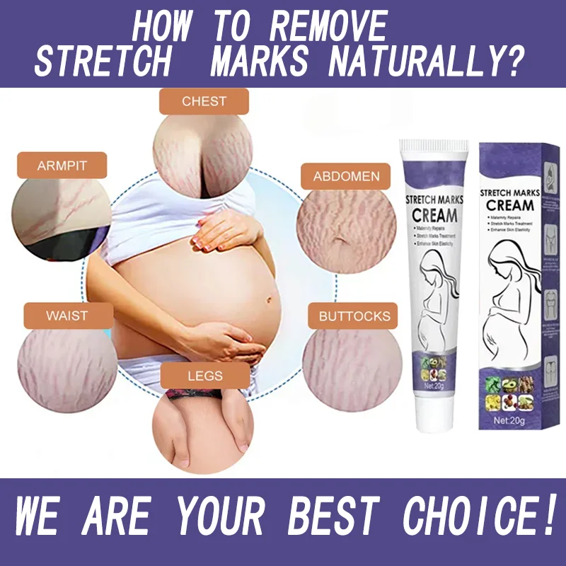 

Stretch Mark Vanishing Cream Firming Skin Body Skin Care Remove Body Buttock Breast Marks Maternity Pregnant Women Pregnancy
