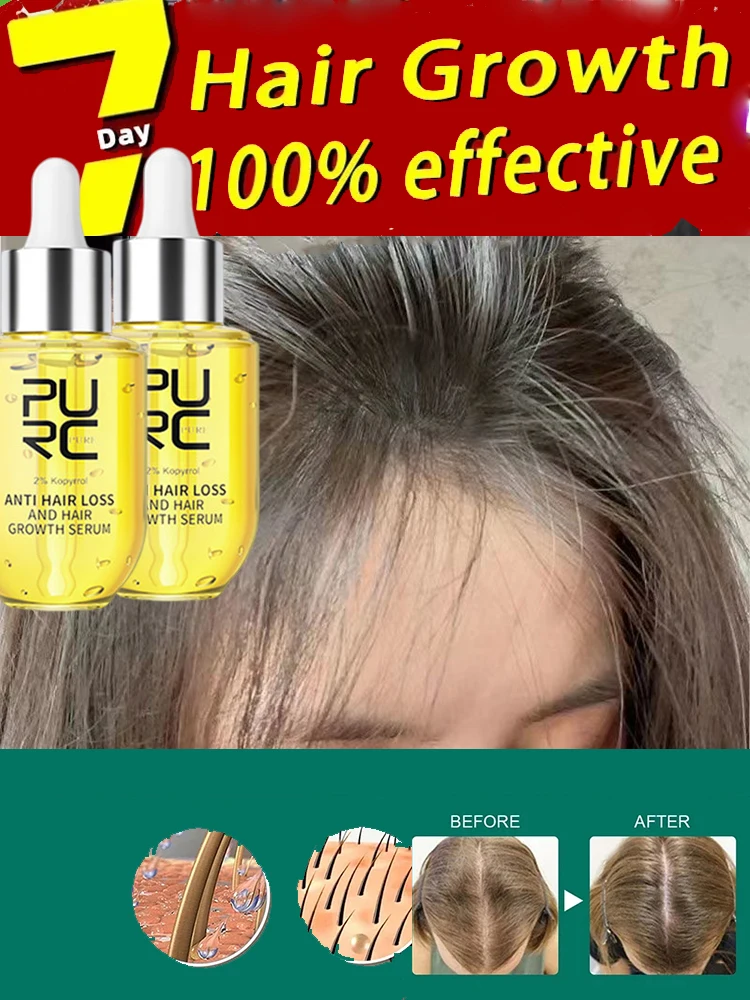 

Fast Hair Growth Serum Anti-Hair Loss Baldness Serum Hairs Care Nurturing hair Reducing hair-loss and breakage