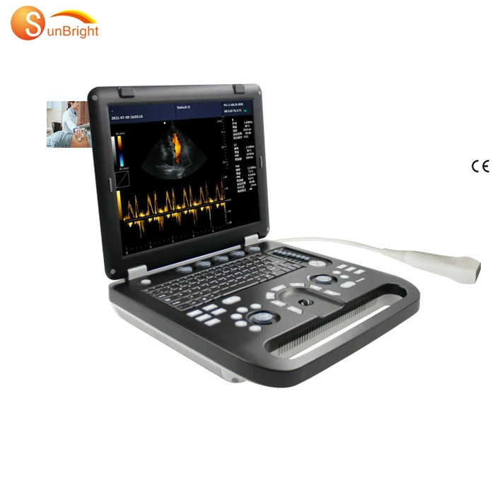 Full Digital Diagnostic Ultrasound System 3d 4d Ultrasound Imaging System Color Doppler Machine