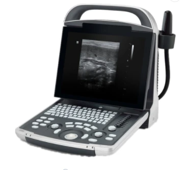 portable ultrasound machine LED screen digital ultrasound scanner for animal and human