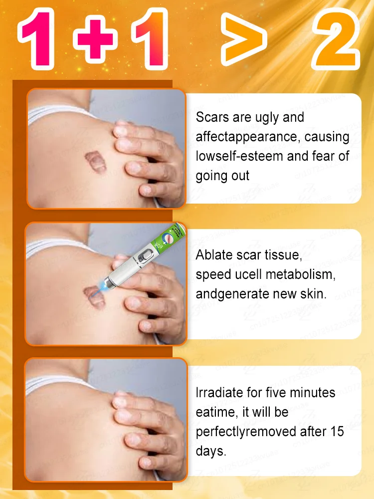 2025 latest laser pen, repair various scars