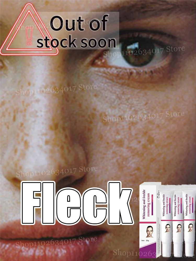 

a touch. Witness the evolution of melasma.Cream