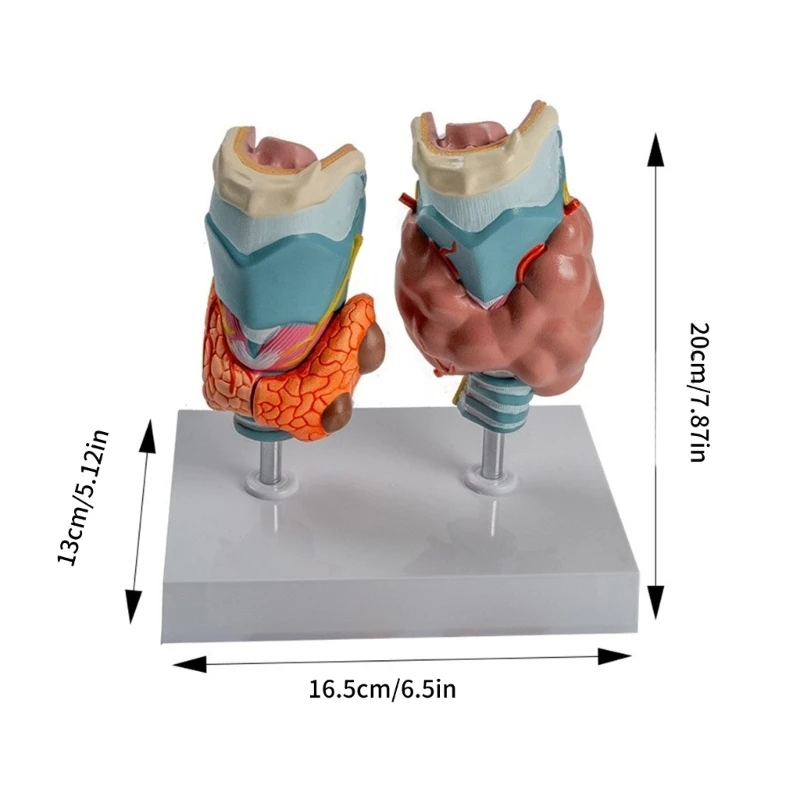 Учебное пособие для модели патологической анатомии щитовидной железы человека, анатомическая патологическая модель горла железы