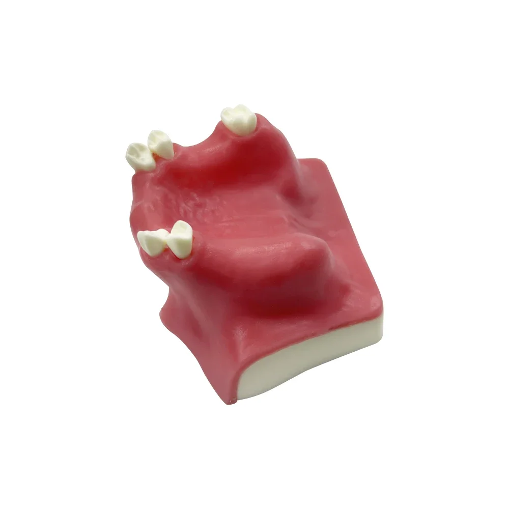 نموذج زرع الجيوب الأنفية الفكية للأسنان المفقودة نموذج اللثة الناعمة لطلاب طب الأسنان لممارسة أدوات التدريس والتدريب #4