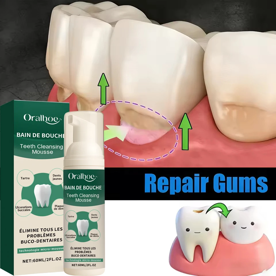 Rapid Repair Gums Mousse Effectively Relieve Tooth Allergy Dental Caries Tooth Cleaning Toothpaste Relieve Tooth Damage Drops