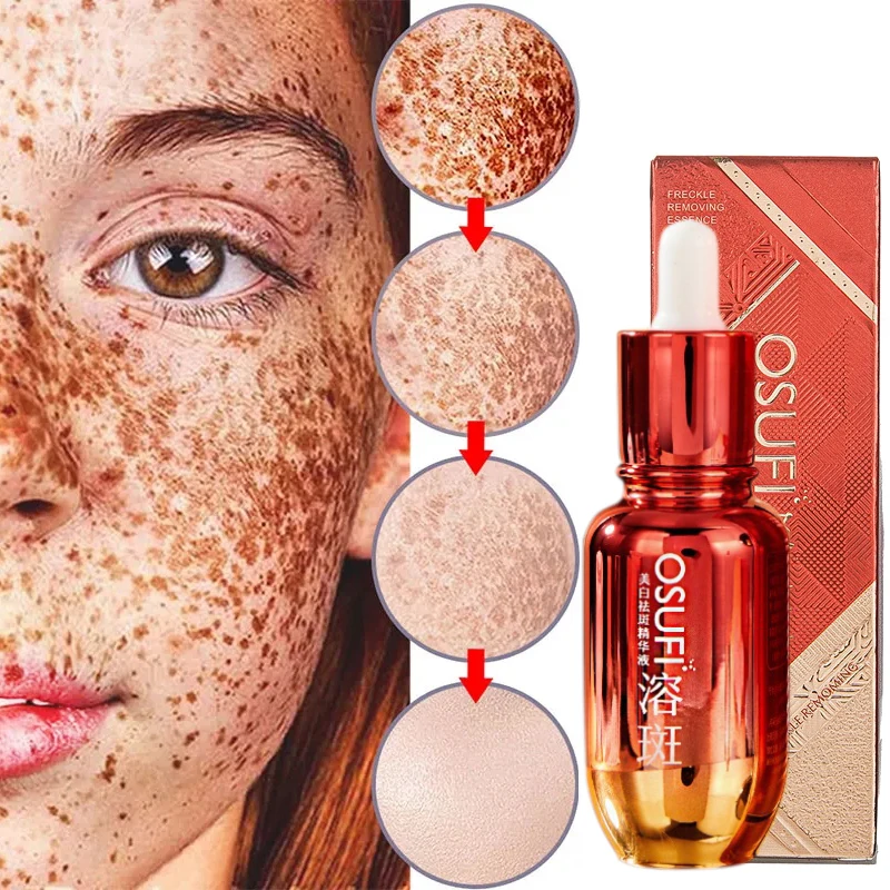 Facial Skin Care Freckle Removal Serum Removing Melasma Sun Spots Lightening Pigments Moisturizing Brightening Whitening 50ml