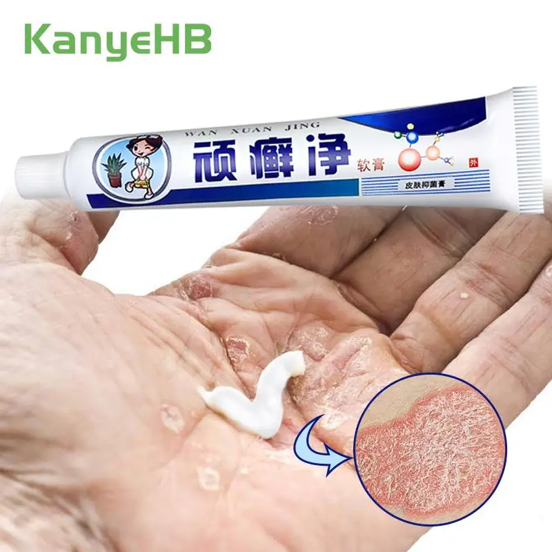 

1Pcs Psoriasis Herbal Cream Antibacterial Relieve Skin Itch Treatment Eczema Dermatitis Rash Tinea Pedis Skin Care Ointment S016