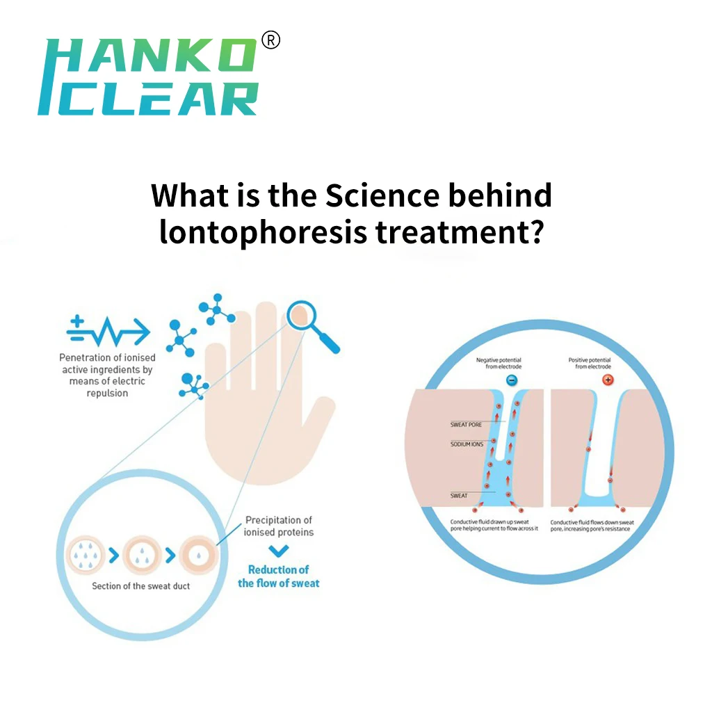 ผ้าเช็ดหน้า®Antiperspirant มือดูแลเท้าเครื่อง iontophoresis เพื่อรักษาเหงื่อออกจากฝ่ามือและเท้าเหงื่อ