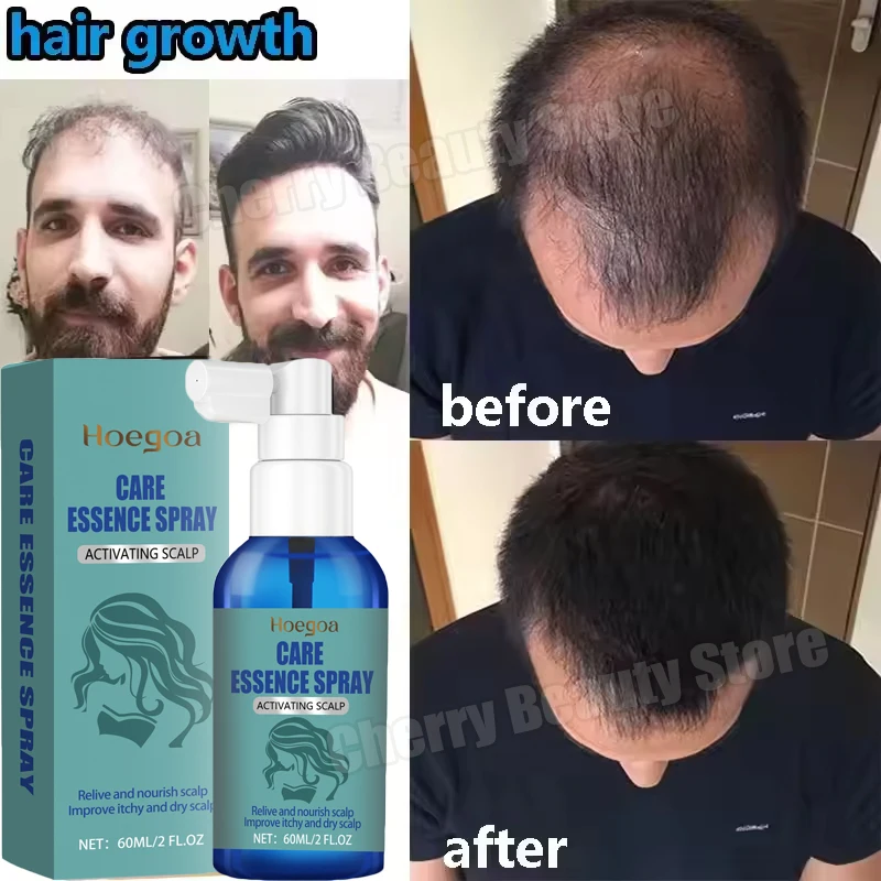 

Сыворотка для быстрого роста волос, восстанавливающая поврежденные волосы, улучшающая обесцвечивание и сухость, уменьшающая секущиеся концы, спрей для лечения выпадения волос.