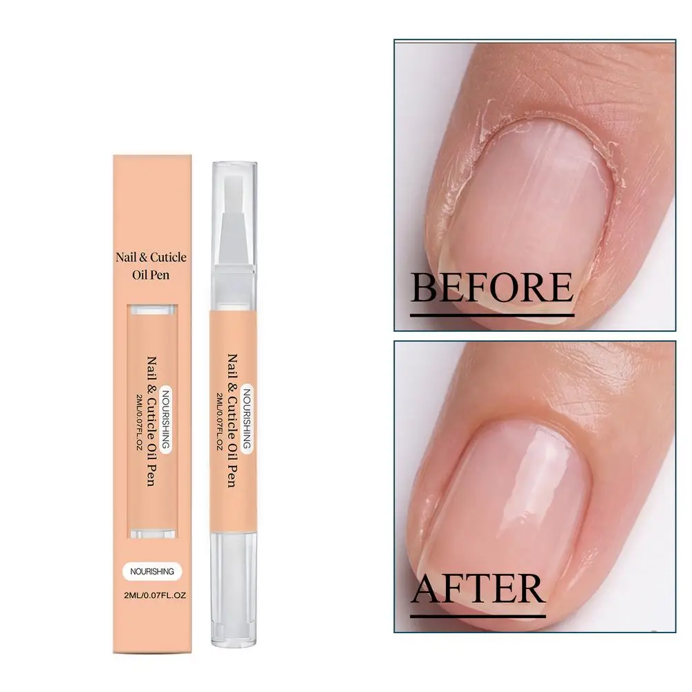 Nail Cuticle Oil Pen Nourishing Nail Repair Treatment Moisturizing Revitalizer Oil Brush Care for Hands Feet Nails