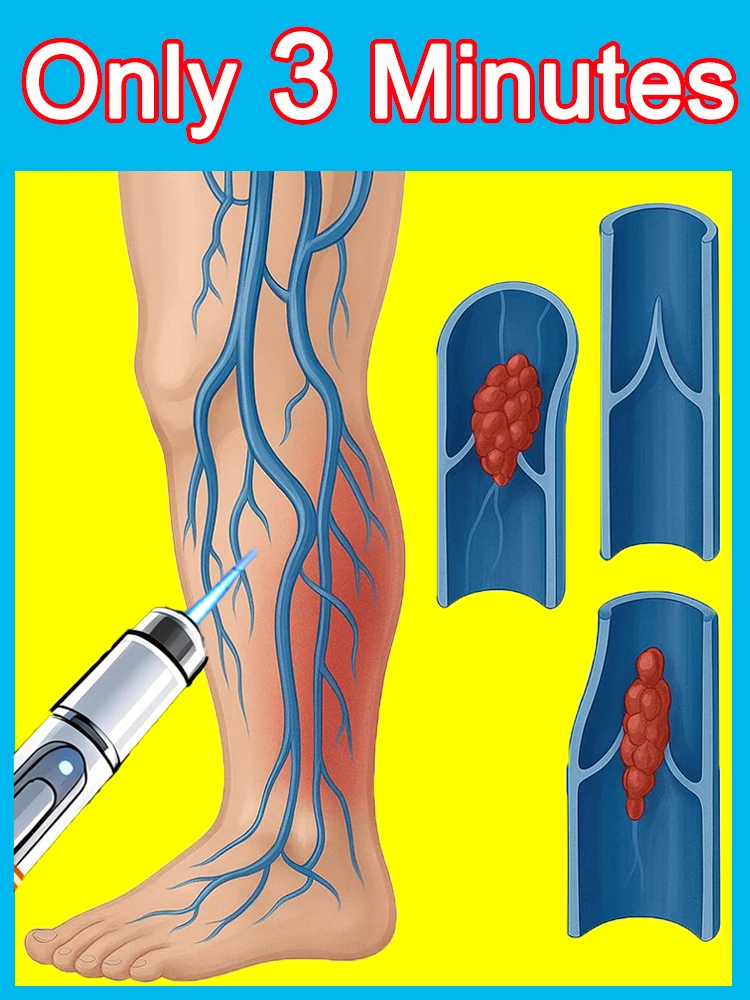 

Veins，Legs That Felt Heavy Now Feel Light With Generation 2 Foot Care Tool Calm Legs Veins