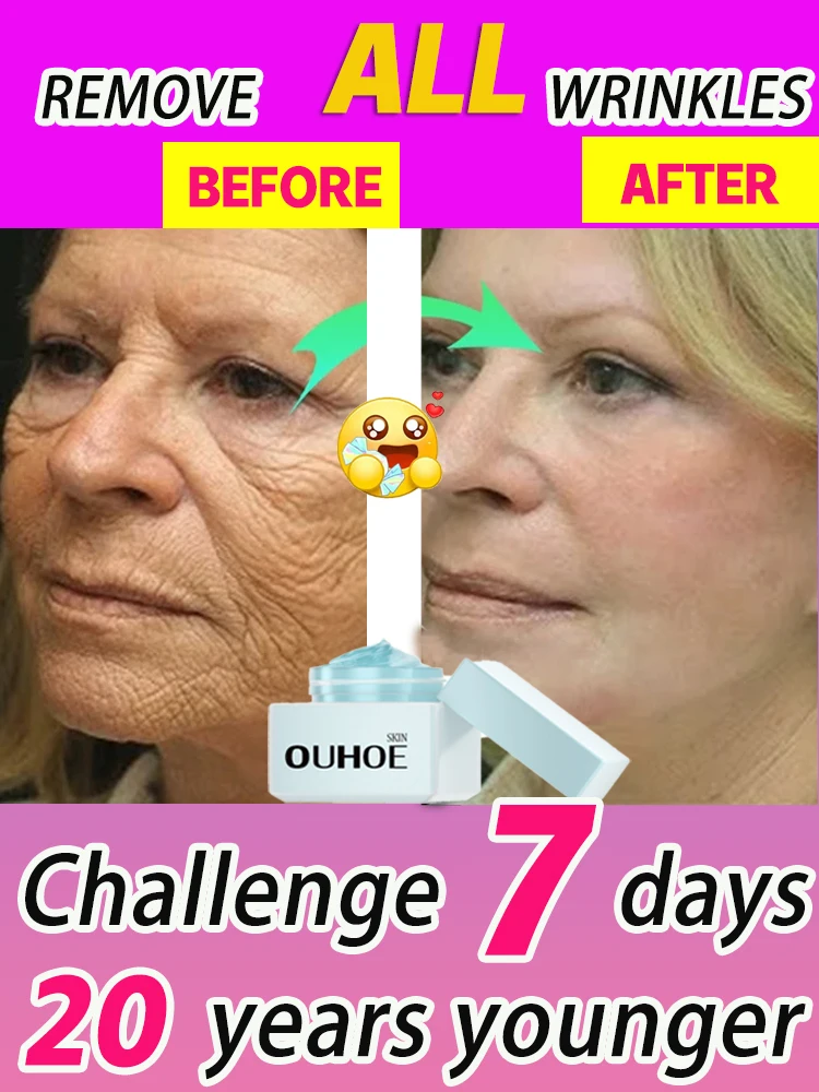 

wrinkles remover korean skin care k-beauty originales anti wrinkle cream anti wrinkle face lift anti aging cre skincare coreanos
