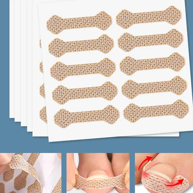 10pcs Ingrown Paronychia Toenail Corrector Strips Anti Nail Patch Feet Sleeping Nail Patch Nails into the Flesh Long Toe Pad image 3