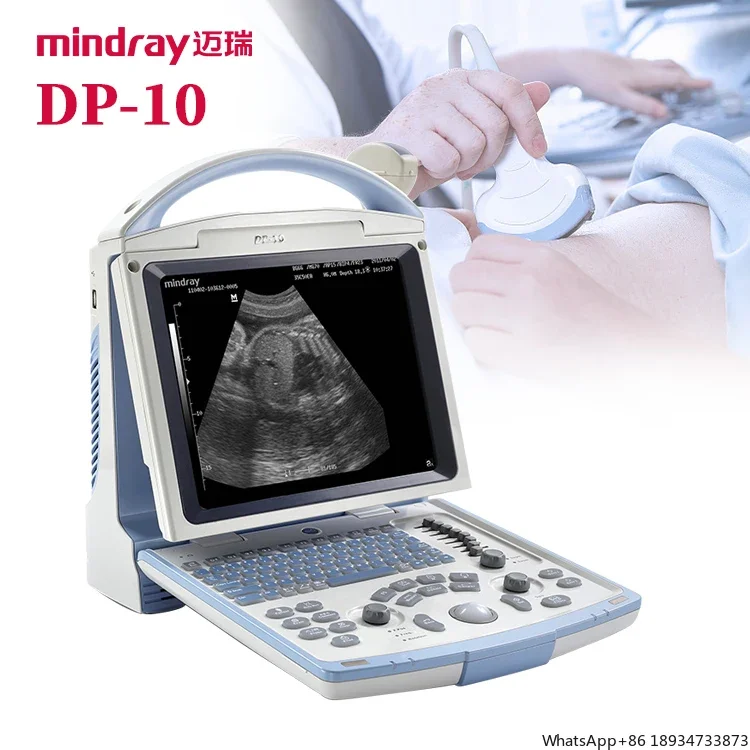 Mindray DP-10 Ultrasound Full Digital Ultrasonic Diagnostic Imaging System B/W Portable Ultrasound Machine