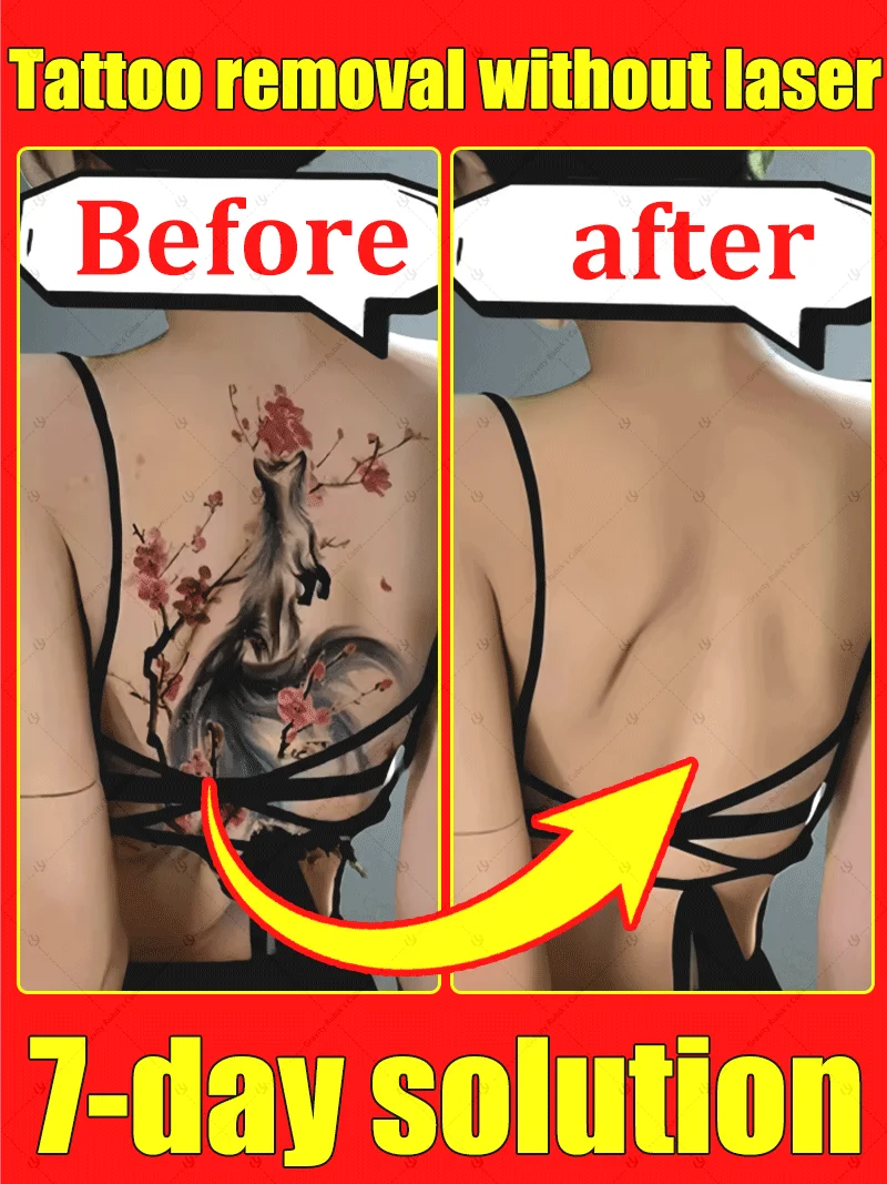 

Tattoo Removal Spray Pigmented Permanent Makeup Tattoo Removal