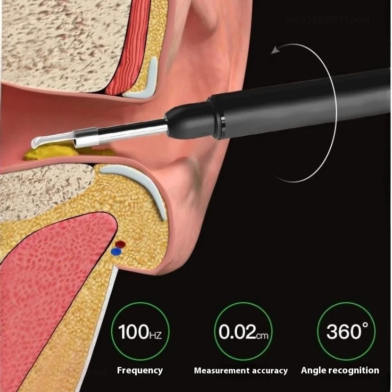Xiaomi Ear Cleaner High Precision Ear Wax Removal Tool with Camera with LED Light Wireless Cleaner Smart Ear Cleaning Kit Care