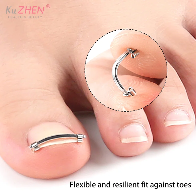 Ingrown Toenail Pedicure Tool Embed Toe Nail Care Straightening Correction Clip Curved Clamp Toenails Correction Tool For Toes