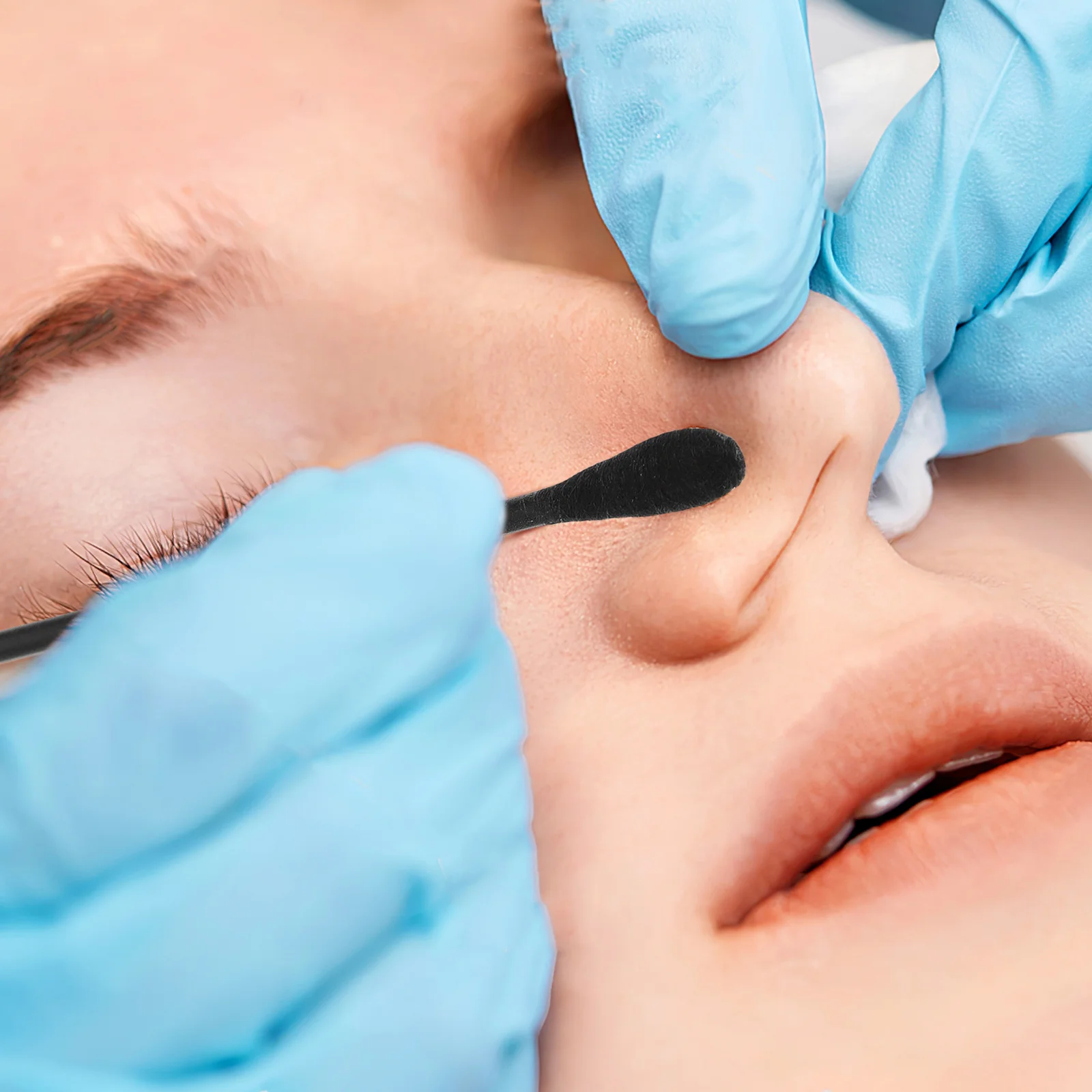 100Pcs Disposable Blackhead Removal Cotton Swabs Double Ended Face Nose Pore Cleansing Tools Skin Care Blackhead Extractor Stick