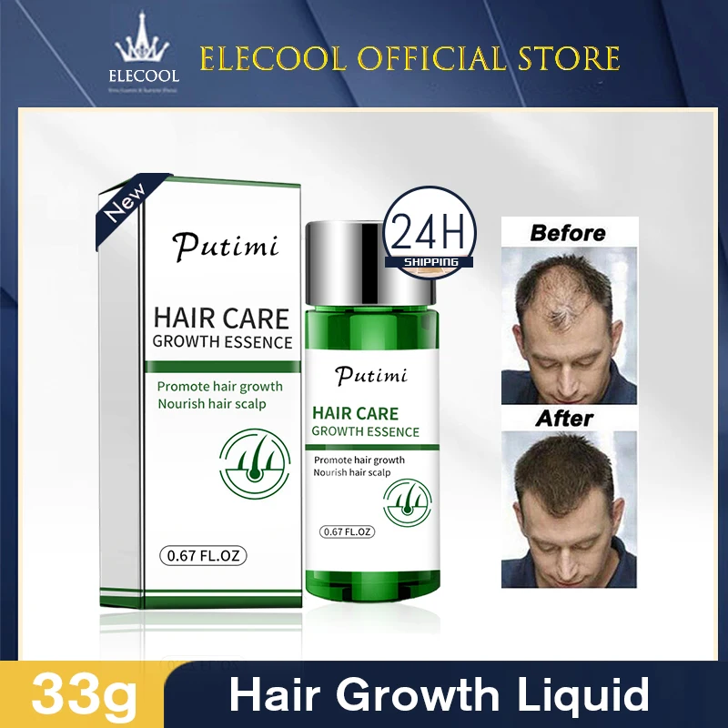 Soro do crescimento do cabelo para homens e mulheres, 30ml, produto natural do cuidado do cabelo para impedir a perda e o cabelo danificado, tslm1