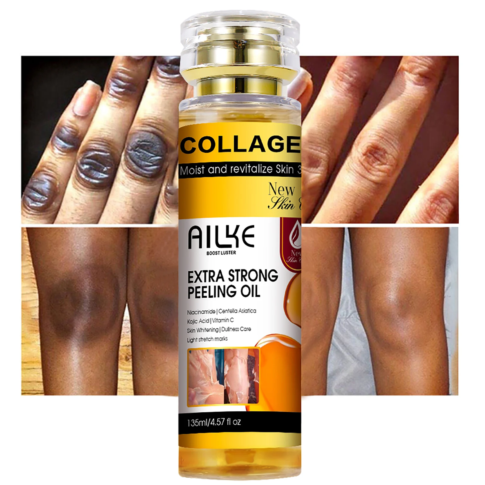 AILKE Collagen Yellow Peeling Oil For All Skin Types, Stretch Mark Removal, Lightening, Improve Rough Skin, Gentle Exfoliation