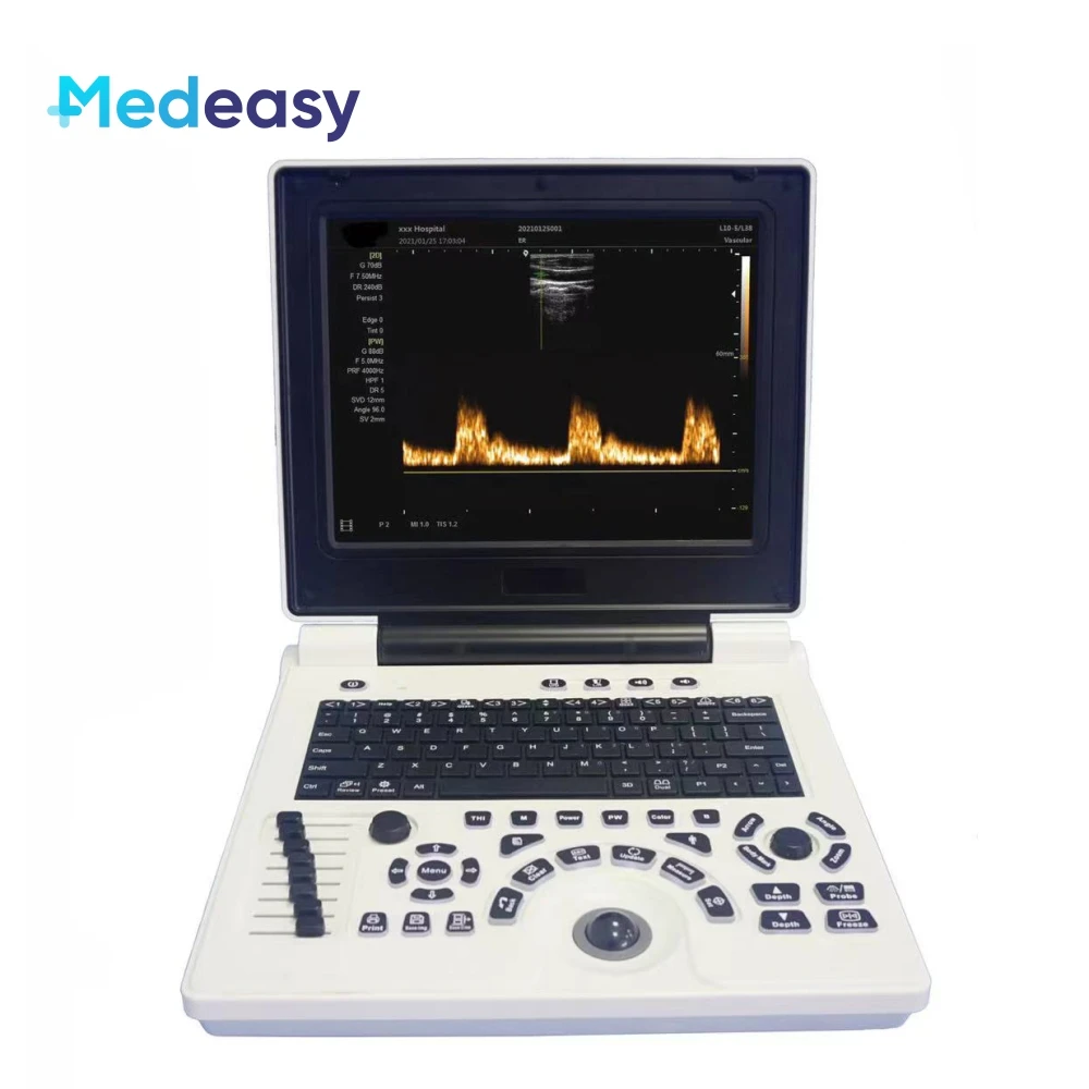 New Laptop B/W Ultrasound Scanner with PW/ IMT Function