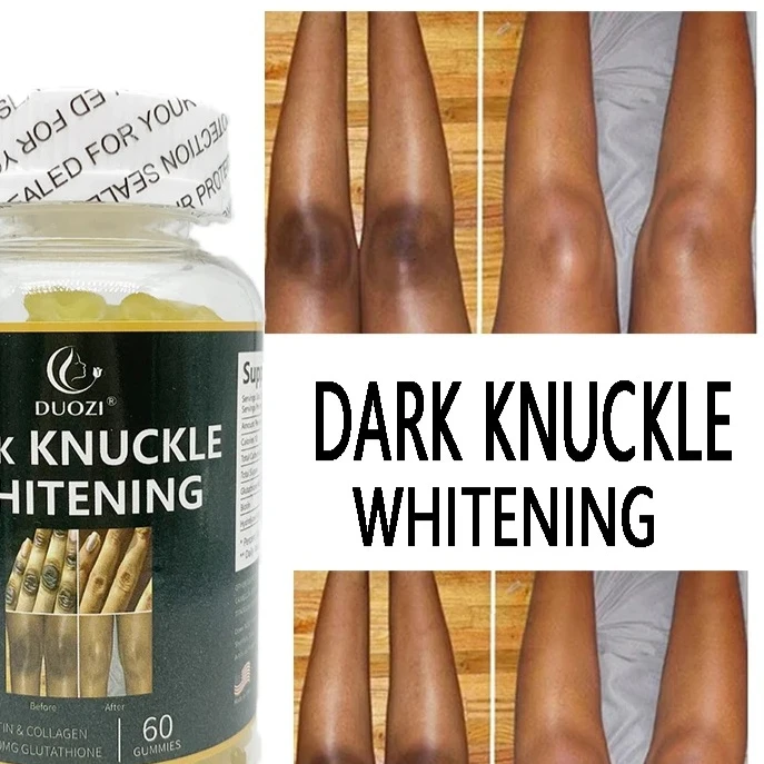 

Повысьте осветление суставов, мягкие конфеты, балансирующий тон кожи, уменьшает морщины, питание от баланса, улучшает тусклость кожи.