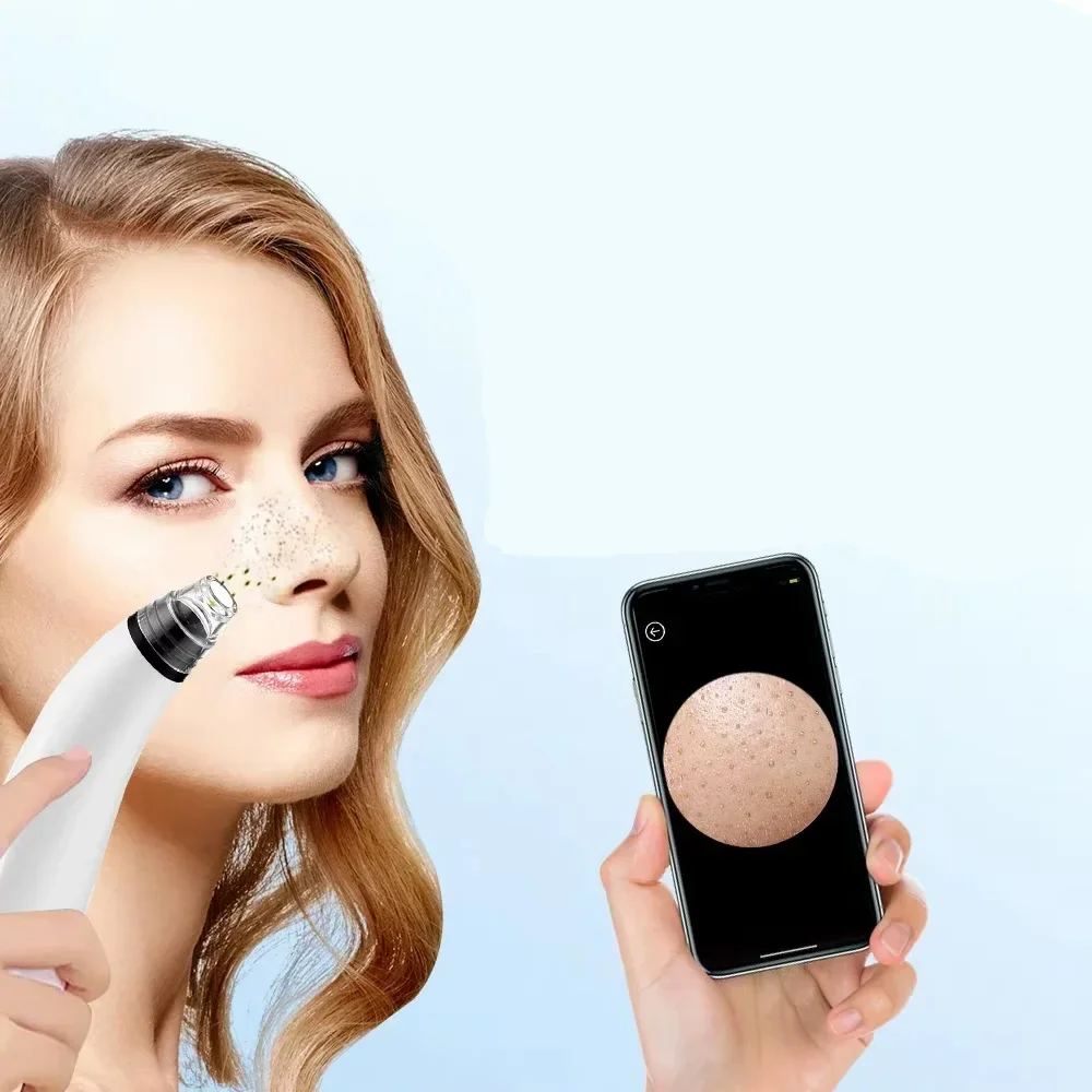 Camera Blackhead Remover Pore Vacuum Suction Pore Cleaner Deep Cleansing Blackhead Remover Pimple Remover Tool