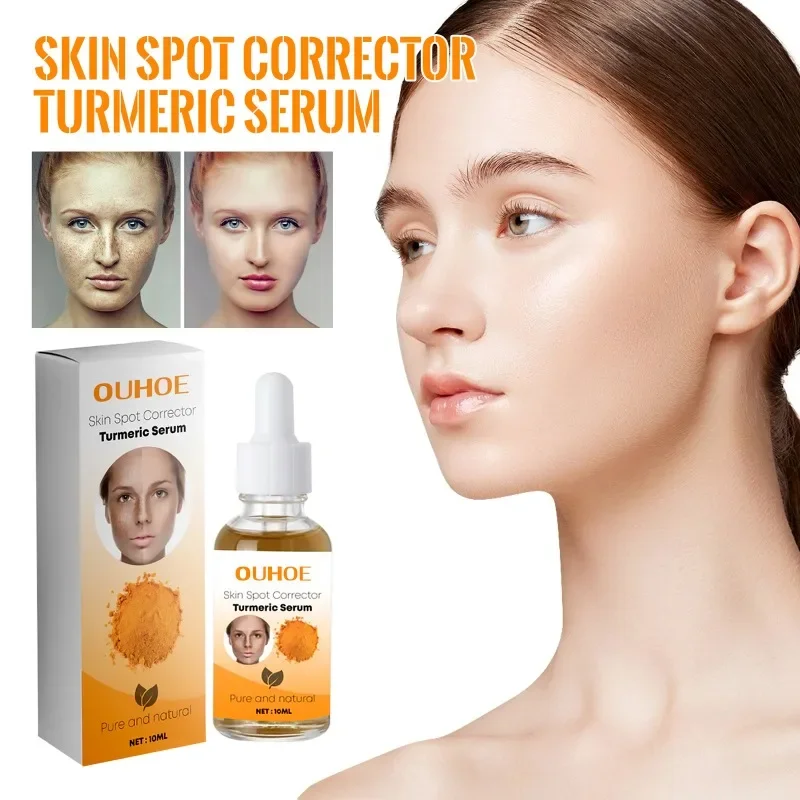 

Sdatter Turmeric Melasma Whitening Correcting Serum Facial Care Essence Oil Dark Spot Removal Brighten Skin Fade Pigment Freckle