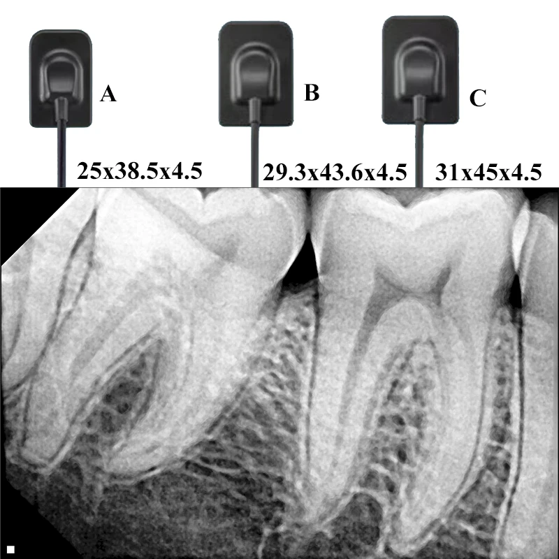 Sistemi di sensori per immagini a raggi X dentali, sistemi di imaging ad alta definizione Strumenti per odontoiatria con sensore intraorale