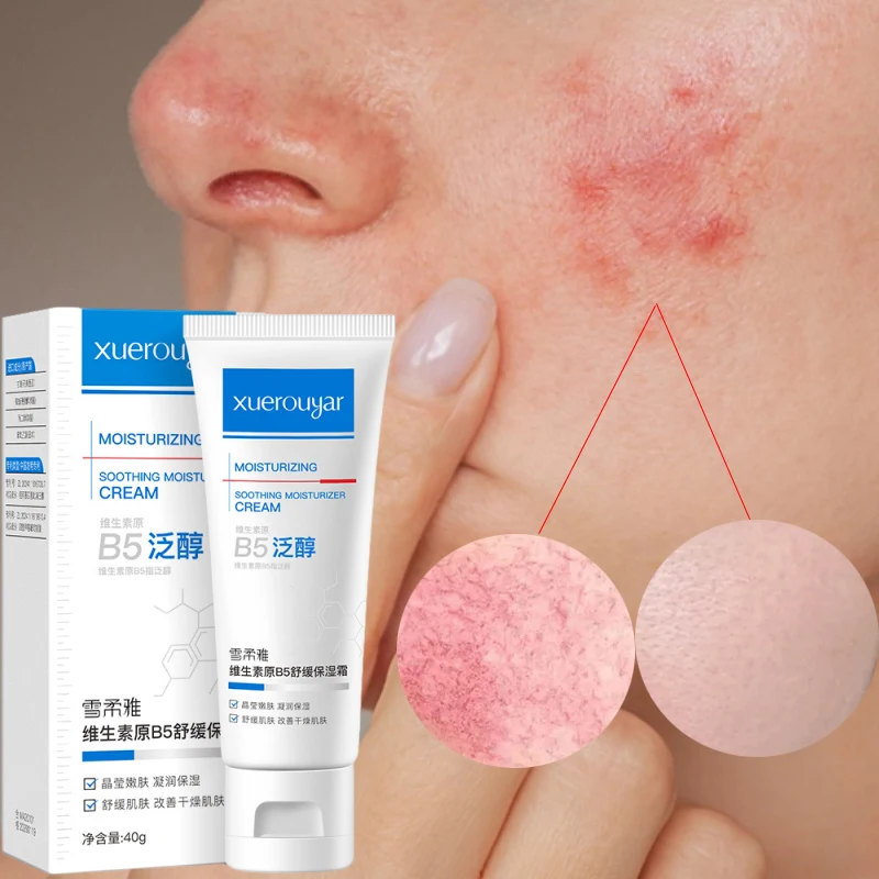 B5 Faded Facial Redness Cream Instant Spider Vein Remove Sensitive Skin Sooth Anti Redness Rosacea Treat Lotion Korean Cosmetic