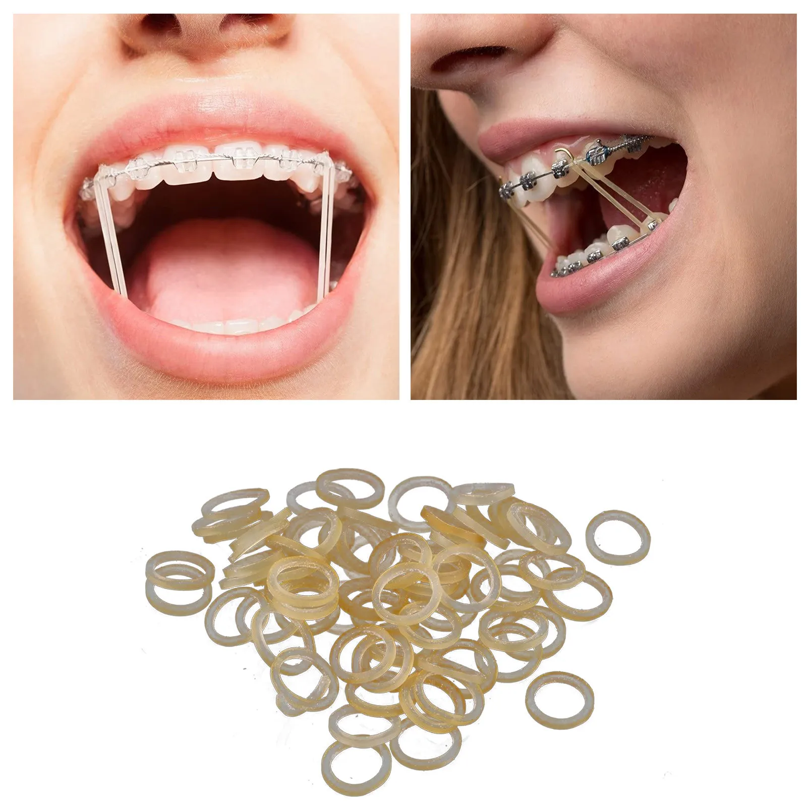 歯のケア、歯のゴムひも、教育変形のための輪ゴム、3.5オンス、3/8 "、100個