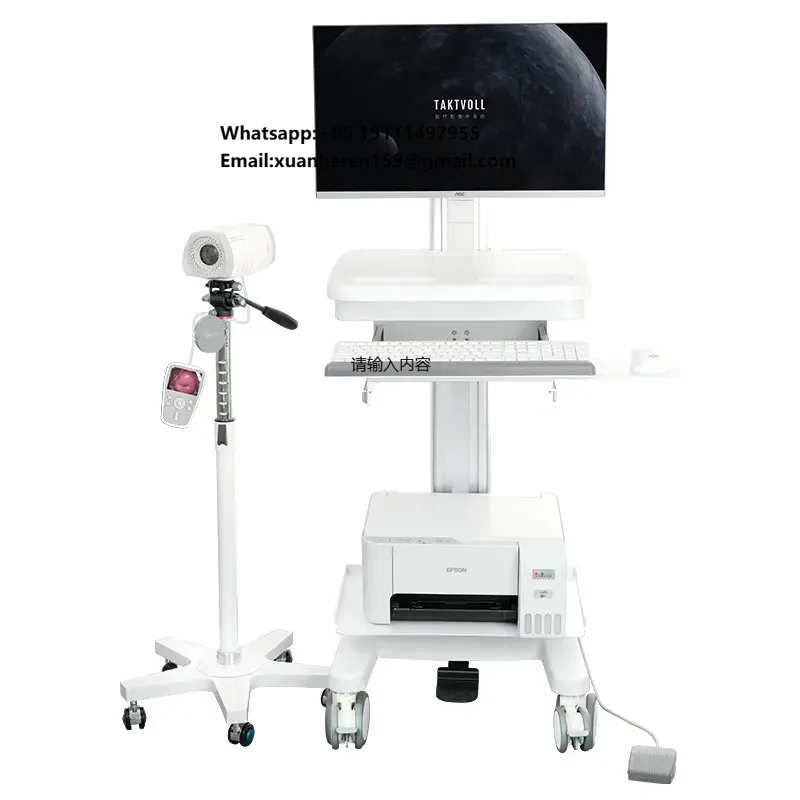 Gynecology ColposcopySY01 Ultra HD Digital Video Colposcop