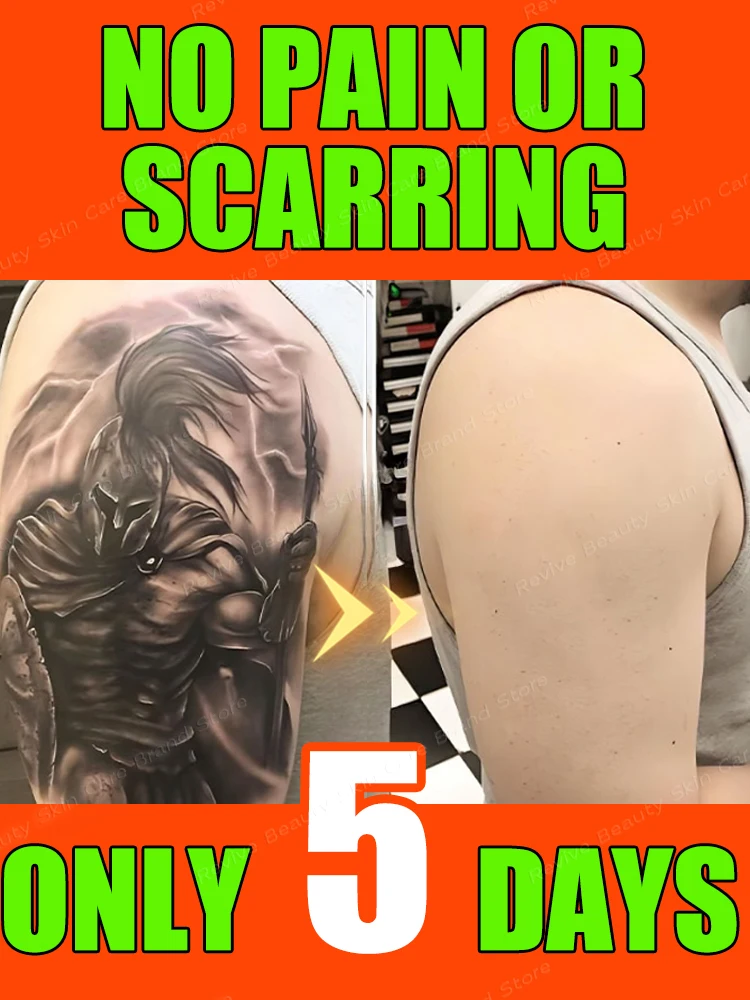 Tattoo Removal Spray Deep Cleaning Tattoos Color Fading Easy To Use Permanent Tattoo Removal