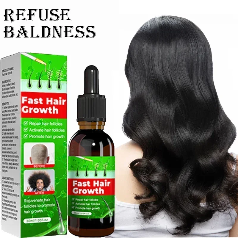 Fast Hair Growth Promoter Products Hair Loss Hereditary Seborrheic Alopecia Treatment Oil For Hair Growth Essence Natural Safety