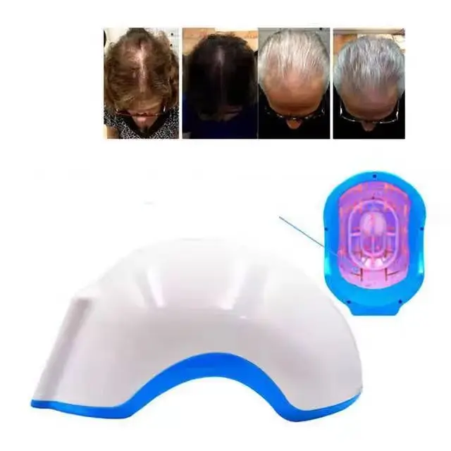 

Лазерный шлем для роста волос — шапочка с красным светом для защиты от выпадения волос и быстрого восстановления (клинически прованные результаты)