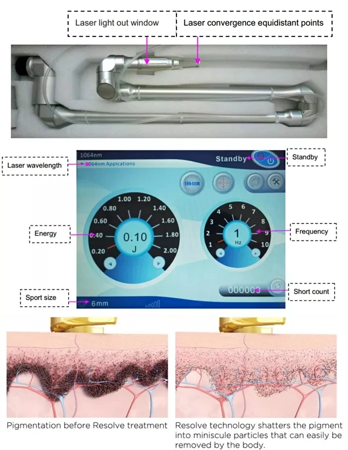 Portable Super Picosecond 532nm 785nm 1064nm new for tattoo removal skin whitening remove freckle removal machine